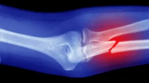Células musculares