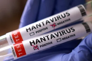 Protocolo cuarentena hantavirus